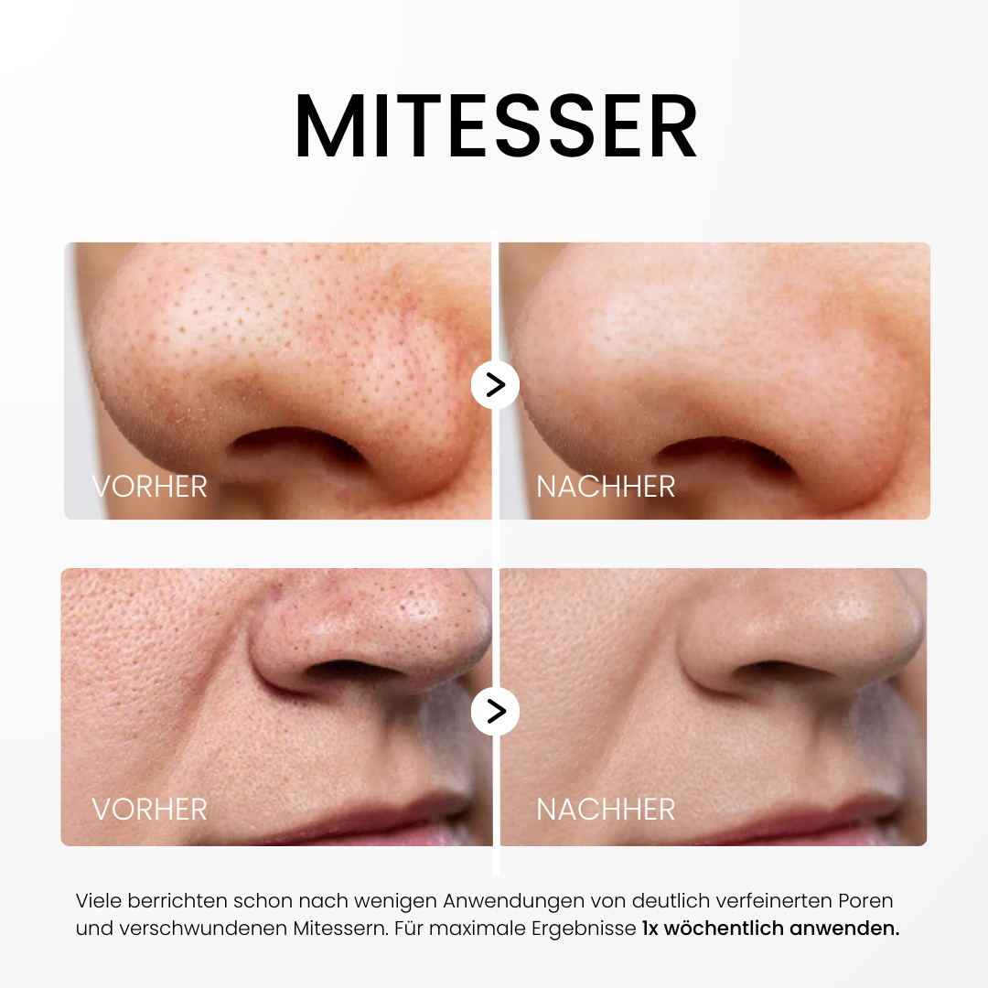 Rice Peel Glow Serum Influencer