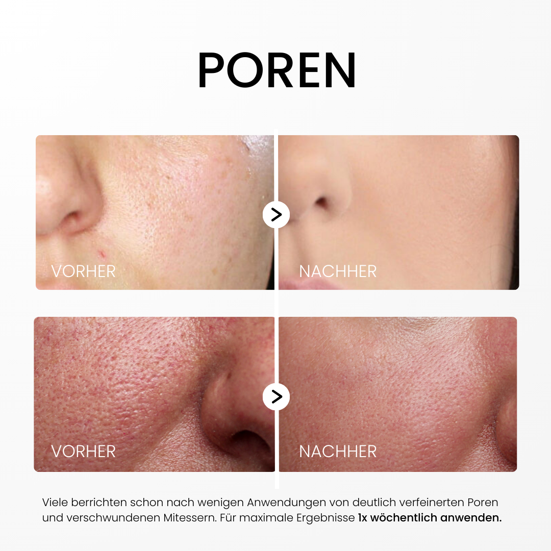 Rice Peel Glow Serum Influencer